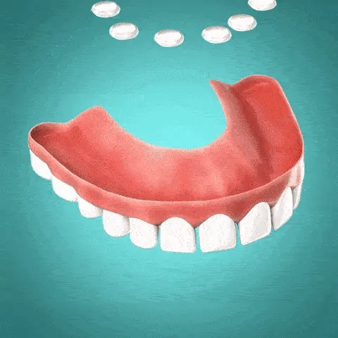 Bliss-Smile® Facettes en silicone