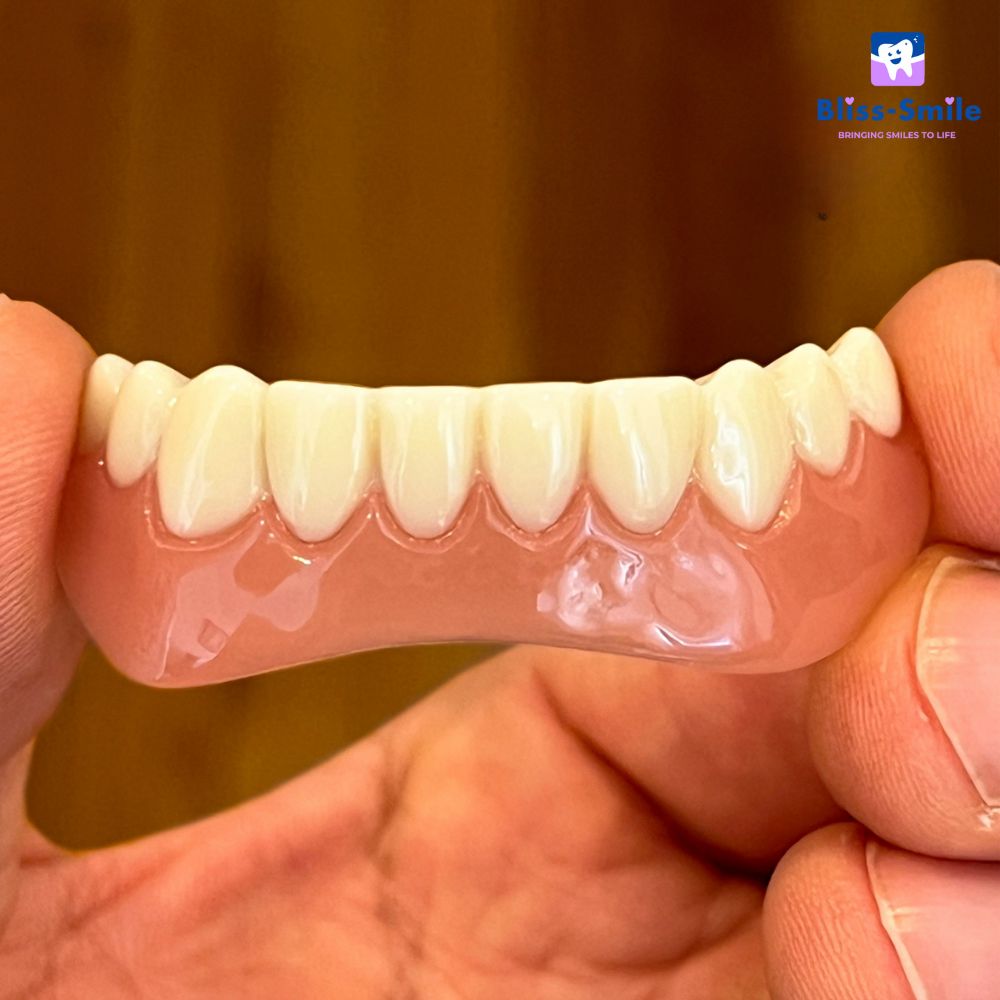 Bliss-Smile® Facettes en silicone
